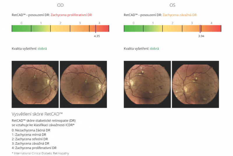 Pre pacientov / A ako to funguje? - foto Pre pacientov / A ako to funguje? - foto