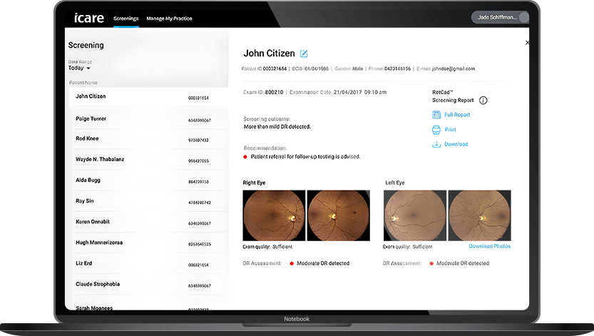 Software Thirona RetCAD™